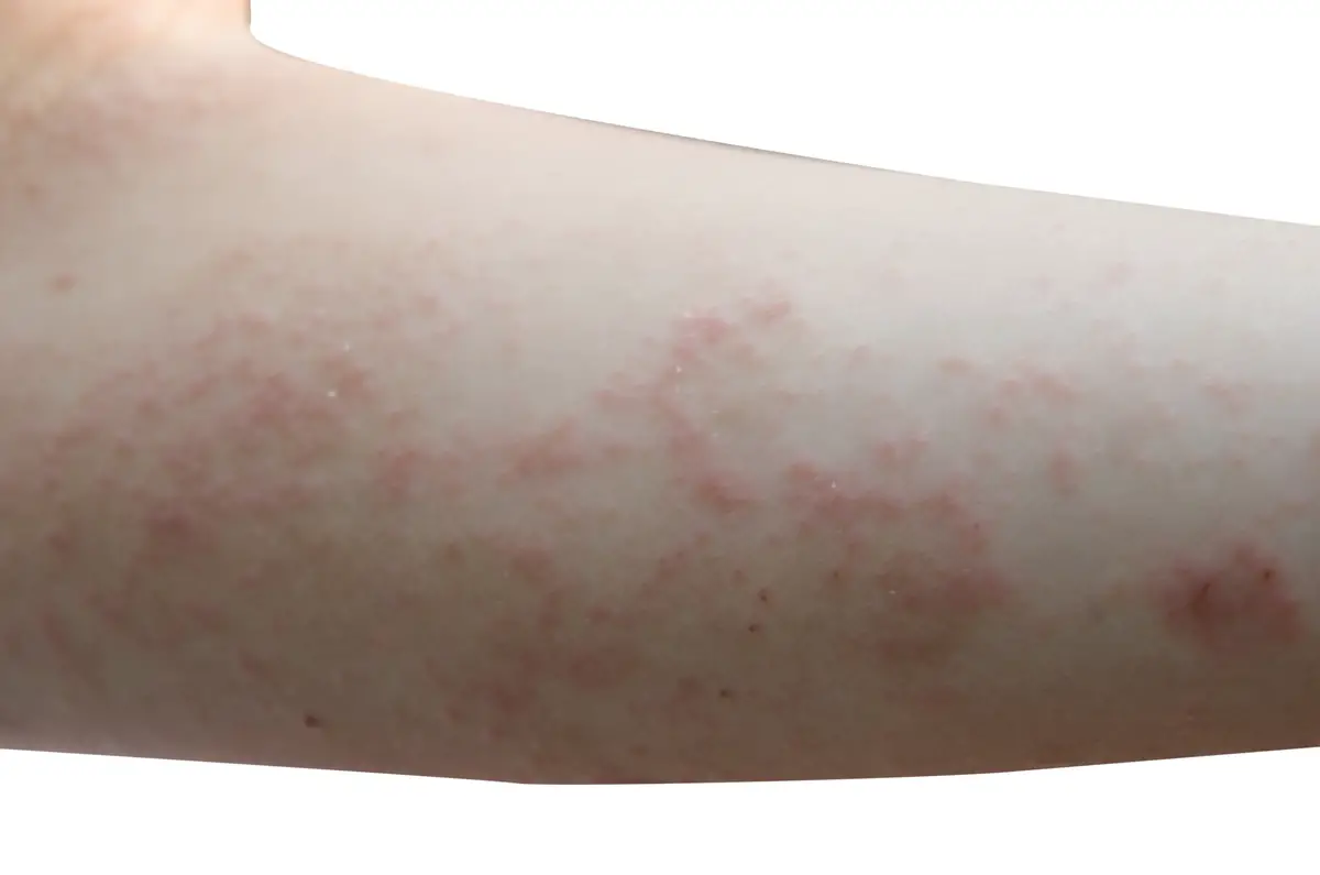 How Often Are Swimming Pools Cleaned? (Private, Public, Hotels)